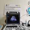 РК Берковица купува мултифункционален дигитален ехограф за МБАЛ гр. Берковица IMG_20200519_110925